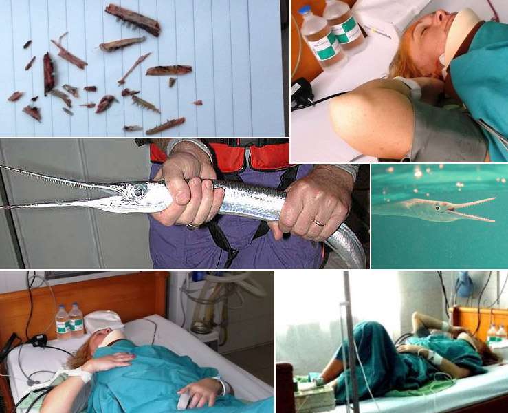Вьетнам: хищная рыба напала на 44-летнюю россиянку